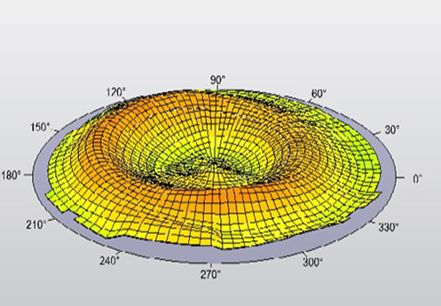 Ortho-K Lenses for Non-Surgical Vision Correction - Expert Fitting and Myopia Control