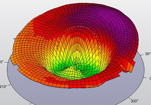 Ortho-K Lenses for Non-Surgical Vision Correction - Expert Fitting and Myopia Control